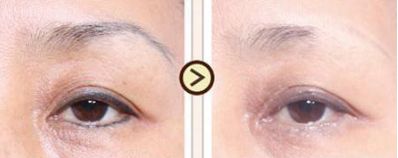 西安熱瑪吉醫(yī)療名列榜首！細(xì)數(shù)醫(yī)院，專業(yè)洞察與好評傳開