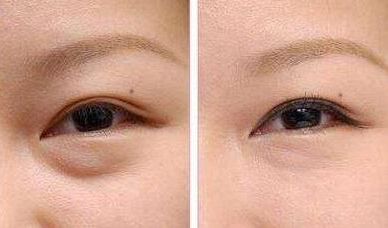 上海九院種植牙醫(yī)生推薦：這幾位牙醫(yī)技術(shù)獨(dú)特，深受患者好評！