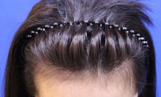 成都潤(rùn)美玉之光醫(yī)療美容醫(yī)生受歡迎嗎？哪些項(xiàng)目是他們擅長(zhǎng)的呢？