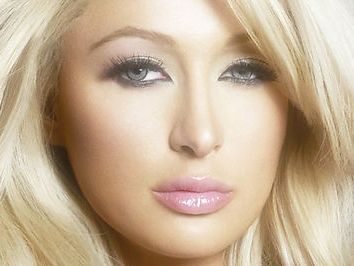 揭秘深圳米蘭柏羽雙眼皮手術口碑：真實案例展示，價格透明公開