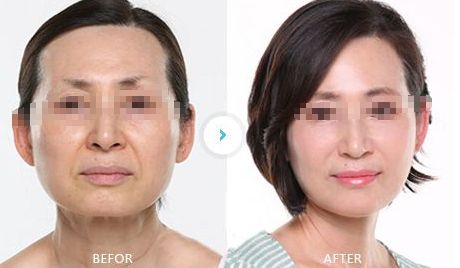 南寧整形醫(yī)院排行榜大揭秘，找準(zhǔn)專業(yè)的整形醫(yī)院才能保證安全與效果