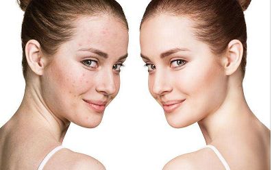 紹興飛秒眼科醫(yī)院人氣榜單出爐：權威專家揭曉十佳選擇