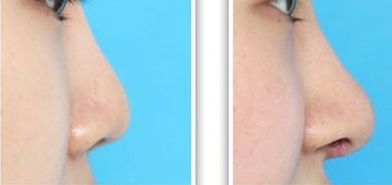 沈陽(yáng)名流整形醫(yī)院專家團(tuán)隊(duì)：王莉莉、董紅星、王松詳解