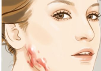 北京哪家醫(yī)院可以洗紋身呢？