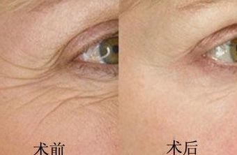 南京鳳凰島整形外科門診部的王科醫(yī)生口碑如何？聯(lián)合李敏醫(yī)生介紹及手術(shù)后的反饋，揭秘這位醫(yī)生的實力！