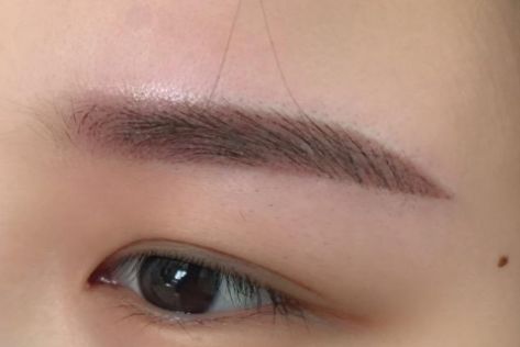 重慶時(shí)光整形美容醫(yī)院高手醫(yī)生幫你輕松遠(yuǎn)離斑點(diǎn)困擾