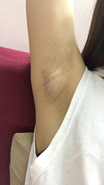 上海健橋植發(fā)技術(shù)實(shí)力如何？頭發(fā)再生效果值得期待嗎？