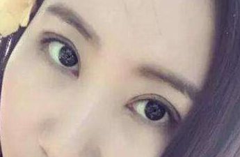 上海華東醫(yī)院整形外科主任醫(yī)師榜單揭曉！先進(jìn)隆鼻療法案例分享及費(fèi)用明細(xì)，急需閱讀！