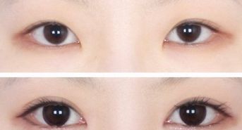 廣州韓后許滿萍醫(yī)生的專業(yè)領(lǐng)域揭秘，令人驚喜的嫩膚案例分享