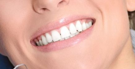 西京醫(yī)院鼻部整形丨馬顯杰教授，項(xiàng)目介紹與真人案例圖解析