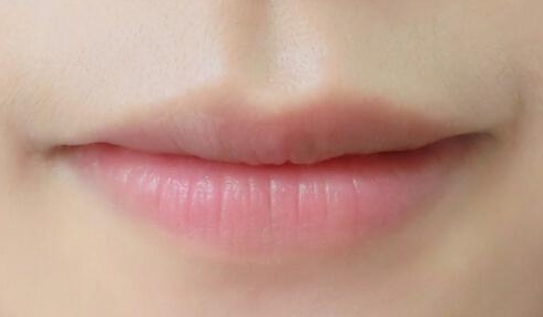 廊坊慧美醫(yī)療美容診所技術(shù)如何？醫(yī)生實力如何？廊坊慧美醫(yī)療美容診所的技術(shù)是否可靠？醫(yī)生的實力如何？