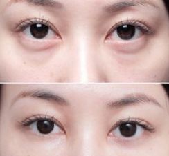 上海美萊醫(yī)院的療效一流，備受好評(píng)的醫(yī)生大揭秘！