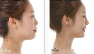 廣州植發(fā)全新醫(yī)院排行榜，權威榜單公布，趕緊收藏！