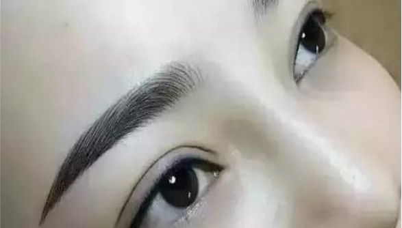 重慶曹陽的鼻子整形效果如何？醫(yī)生手藝獨(dú)步天下的真實(shí)案例分享