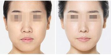 深圳整形美容醫(yī)院排名前十，哪家更受用戶好評(píng)？