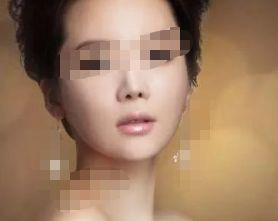 珠海有哪些專(zhuān)業(yè)整形醫(yī)院值得推薦？