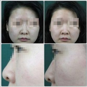 長沙哪家整形醫(yī)院排名靠前，技術專業(yè)受用戶好評