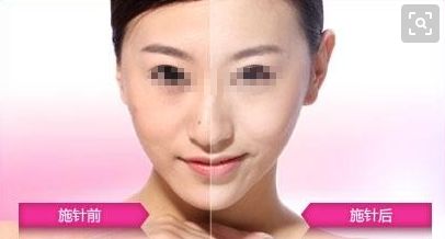 國(guó)內(nèi)整形醫(yī)院排行榜TOP10