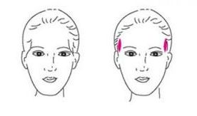 長沙去斑哪家醫(yī)院效果好？三甲醫(yī)院推薦！