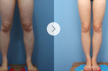 上海整容醫(yī)院排行：領(lǐng)先全球的磨骨技術(shù)，醫(yī)院評分驚人！