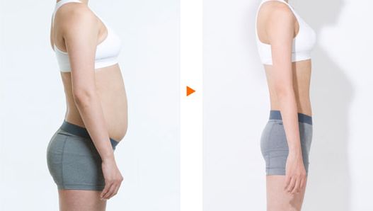 陳振宇的雙眼皮手術(shù)效果如何？在青醫(yī)附院的真實案例鑒賞提供參考