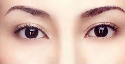 霍玉旺：中國(guó)鼻型塑造的頂尖大師！真實(shí)案例揭秘！