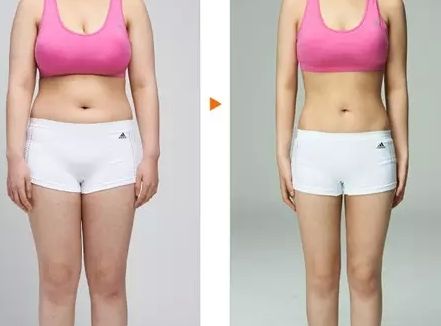 貴陽市雙眼皮整形醫(yī)院推薦！四家專業(yè)醫(yī)院綜合對比