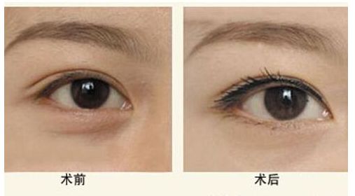 廣州墊下巴哪家醫(yī)院好？口碑技術(shù)分析及價格參考