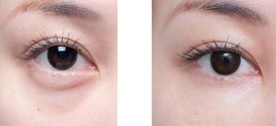 沈陽整形醫(yī)院精心挑選，排名領(lǐng)先醫(yī)院揭曉