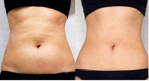 上海葉麗萍醫(yī)生進(jìn)行鼻部整形效果如何？最新成功案例曝光