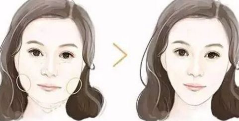 廣州拉皮手術(shù)哪里做效果好？華美、曙光等知名醫(yī)院上榜！