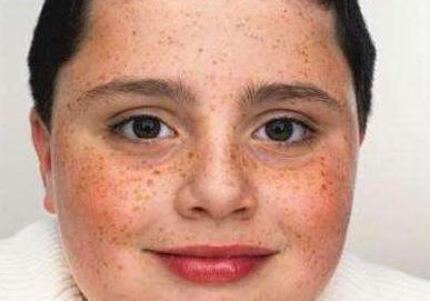 武漢協(xié)和醫(yī)院整形外科引領(lǐng)23年隆胸事例放映