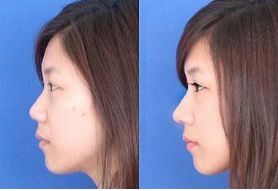 上海整形醫(yī)院排行榜前三資深專家力薦！整容技術(shù)卓越，名副其實(shí)！