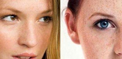 黃久佐醫(yī)生為你分享雙眼皮效果及技術(shù)測(cè)評(píng)！