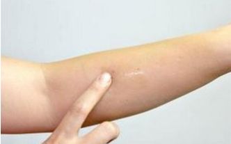 上海脂肪抽吸醫(yī)生技術(shù)大比拼，排行前十新榜單揭曉