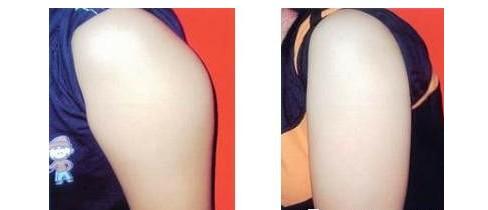 上海九院的整形價格表是怎樣的？它適合想要變美的人嗎？