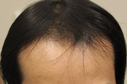 安慶整形美容醫(yī)院都有哪些？哪家公立整形科口碑比較好？價格一覽_附專家解讀