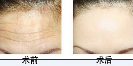 排行榜前十！沈陽植發(fā)醫(yī)院技術(shù)高超有口碑