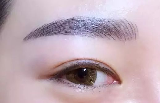 重慶王量醫(yī)生的面部脂肪填充案例一覽