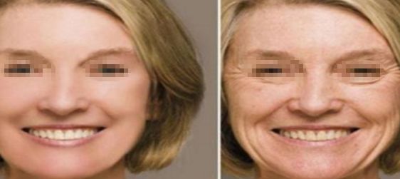 大連許英醫(yī)療美容如何？找到適合你的完美美容之處