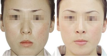 【2024上海民營整形醫(yī)院】精選知名機構(gòu)盤點，醫(yī)療美容好去處！