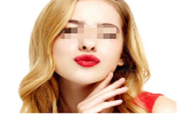 鄭州美萊枝蔓雙眼皮手術(shù)評價(jià)分享，價(jià)格公道有保障