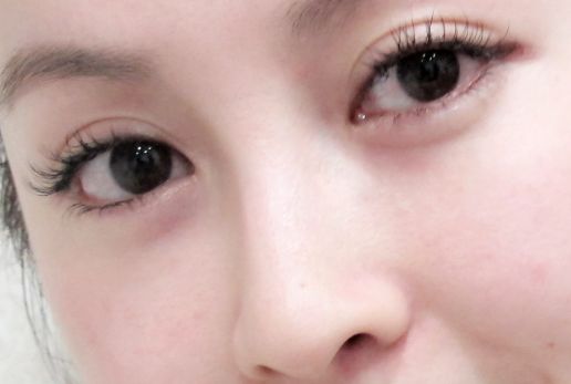 汕頭哪家醫(yī)美機構(gòu)正規(guī)可信呢？