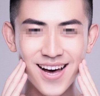 北京治疤痕手術(shù)哪家醫(yī)院好？