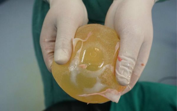 太原整形醫(yī)院強(qiáng)勢(shì)入圍排名前十，多家私立優(yōu)質(zhì)醫(yī)美備受推崇，絕對(duì)值得選擇！