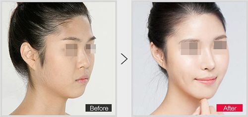 蘭州那家醫(yī)院能治療磨骨比較好？