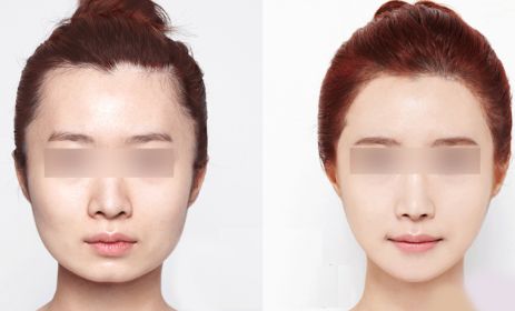 昆明哪里有最好的眼部手術(shù)整形醫(yī)院？2024年10家排名搶先曝光！