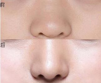 江蘇地區(qū)乳房整形醫(yī)院排行榜，受矚目醫(yī)療機構在線一覽