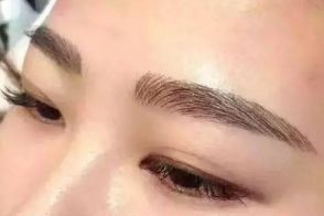 絕佳效果！體驗成都周維開刀雙眼皮的精彩案例