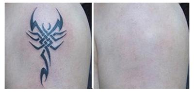 山西省整形外科醫(yī)院劉晉元好不好？割雙眼皮有何特色，值得信賴嗎？